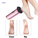 ZapSole™ Type-C Electric Foot File | Smooth, Callus-Free Feet at Home